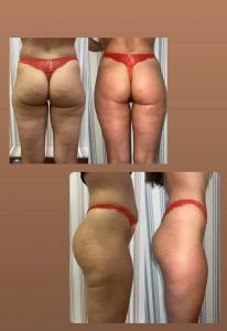 Фотография Body Fly 5