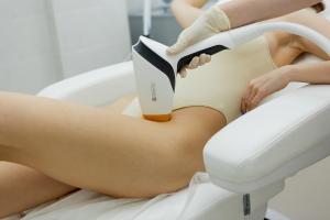 Фотография Epilion 2